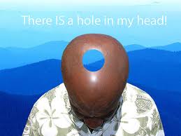 HoleinHead