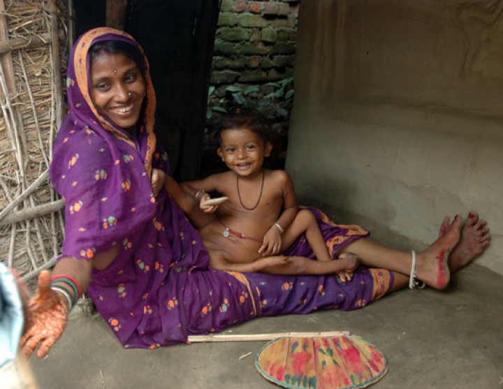 People Born with Extra Body Parts